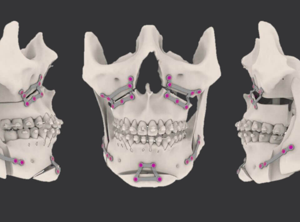 la tecnologia per raddrizzare un viso asimmetrico