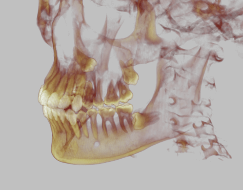 dente del giudizio 3d traparente